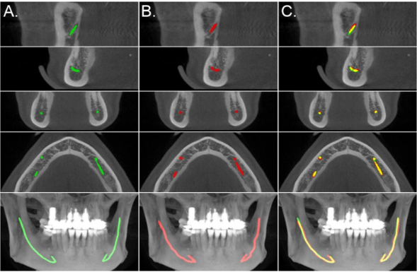 CBCT Scans and AI: A Match Made for Modern Dentistry